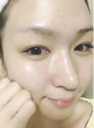 フィトリフト使用後の肌