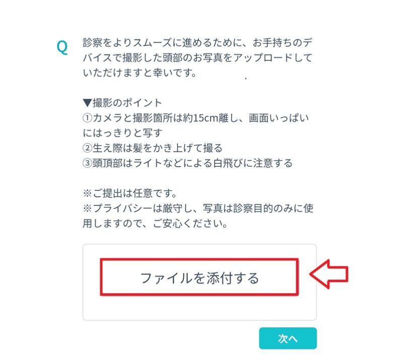 頭頂部や生え際の写真添付